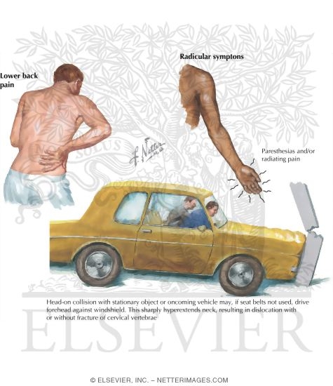 Watermarked preview of labeled image: History of Pain In the Spine