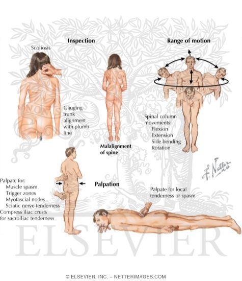 Watermarked preview of labeled image: Physical Examination of the Spine