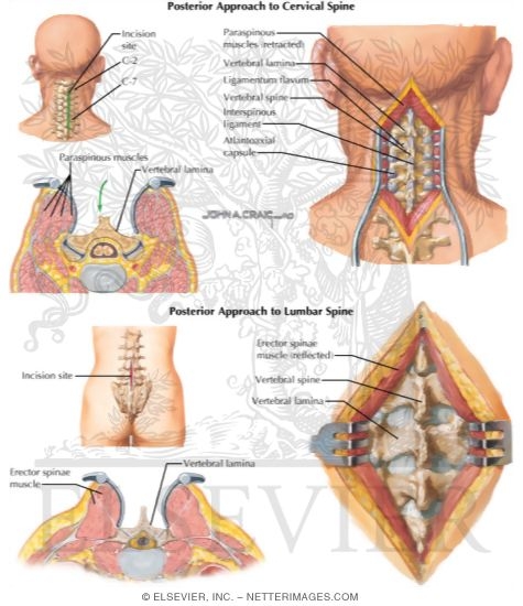 脊椎脊髄の手術 = Illustrated Surgery of Spine … 脊椎脊髄の手術 = Illustrated Surgery of Spine …