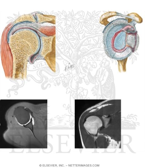 Watermarked preview of unlabeled image: Joints of the Shoulder