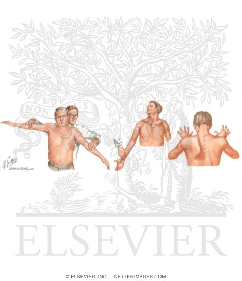 Watermarked preview of unlabeled image: Physical Examination of the Shoulder