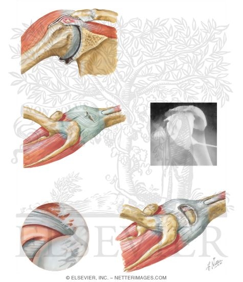 Watermarked preview of unlabeled image: Disorders of the Shoulder