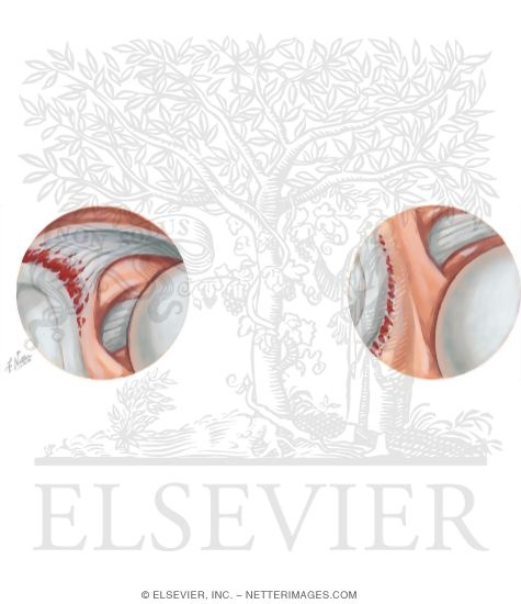 Watermarked preview of unlabeled image: Disorders of the Shoulder