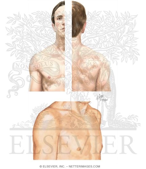 Watermarked preview of unlabeled image: Surgical Approaches to the Shoulder