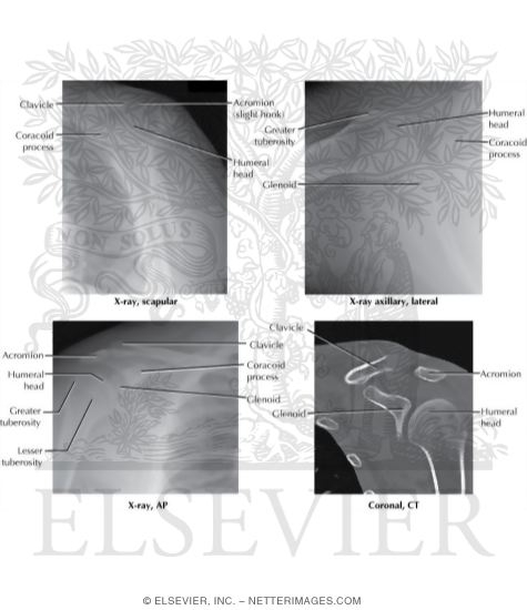 Watermarked preview of labeled image: Radiology of the Shoulder