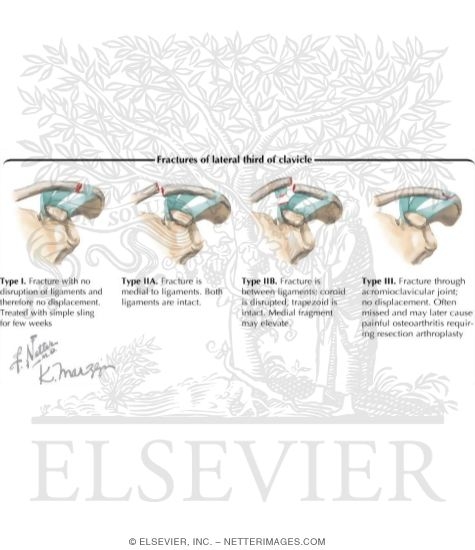 Watermarked preview of labeled image: Trauma of the Shoulder
