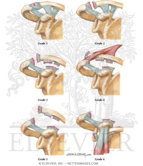 Watermarked preview of labeled image: Trauma of the Shoulder
