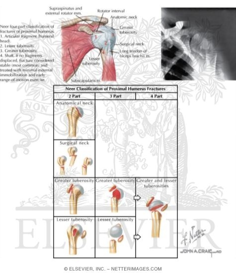 Watermarked preview of labeled image: Shoulder Trauma