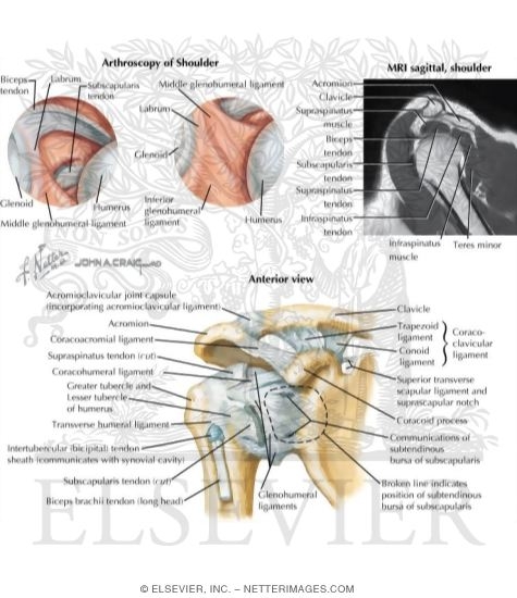 Watermarked preview of labeled image: Arthroscopy of the Shoulder