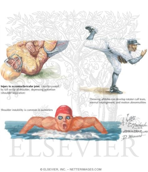Watermarked preview of labeled image: History of Injury to the Shoulder