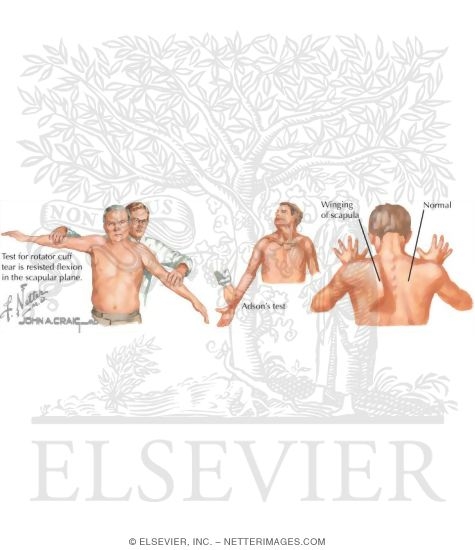 Watermarked preview of labeled image: Physical Examination of the Shoulder