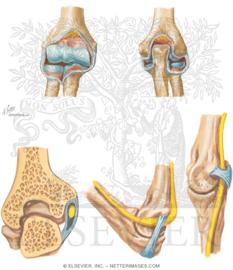 Watermarked preview of unlabeled image: Elbow Stability and Cubital Tunnel