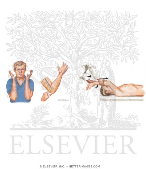 Watermarked preview of unlabeled image: Physical Examination of the Arm