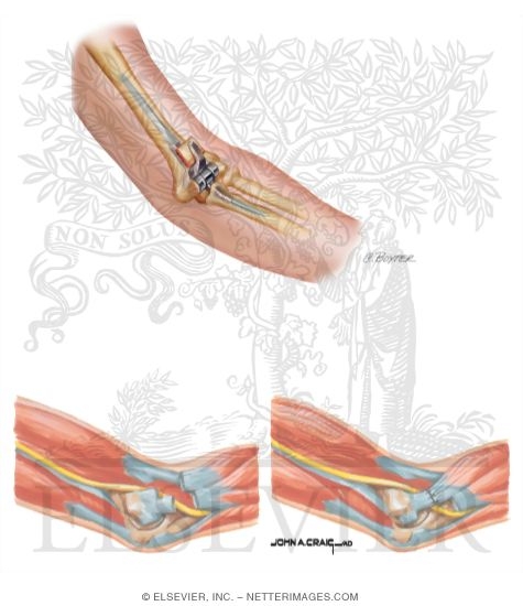 Watermarked preview of unlabeled image: Disorders of the Arm