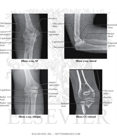 Watermarked preview of labeled image: Radiology of the Arm