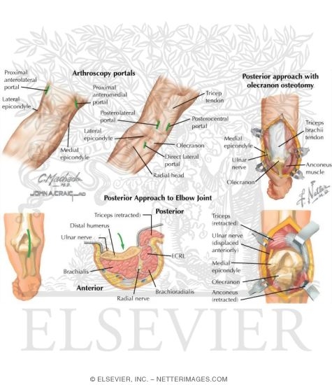 Watermarked preview of labeled image: Surgical Approaches to the Upper Arm and Elbow (Continued)