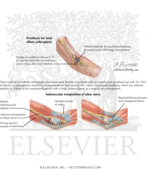 Watermarked preview of labeled image: Disorders of the Arm