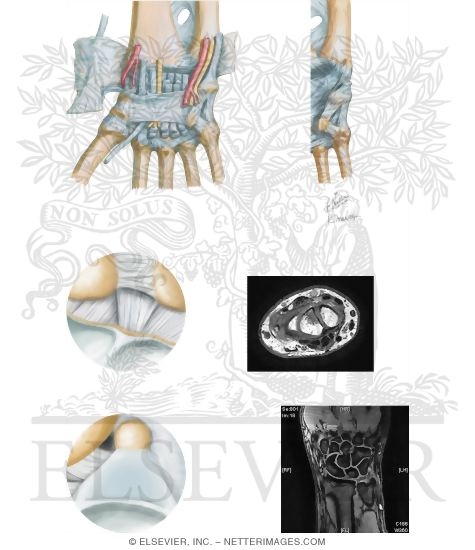 Watermarked preview of unlabeled image: Joints of the Forearm