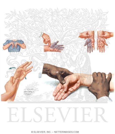 Watermarked preview of unlabeled image: Physical Examination of the Forearm