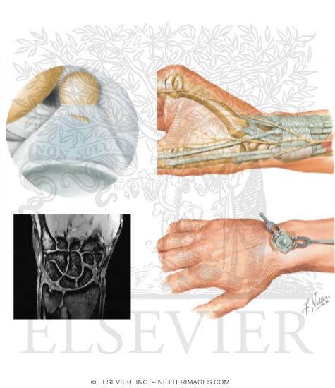 Watermarked preview of unlabeled image: Disorders of the Forearm