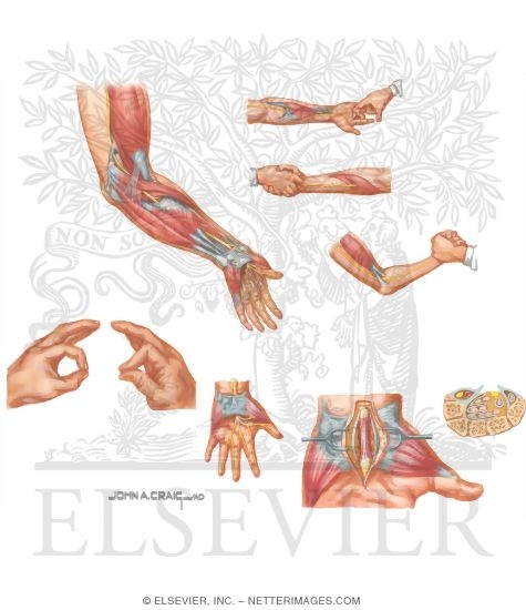 Watermarked preview of unlabeled image: Disorders of the Forearm