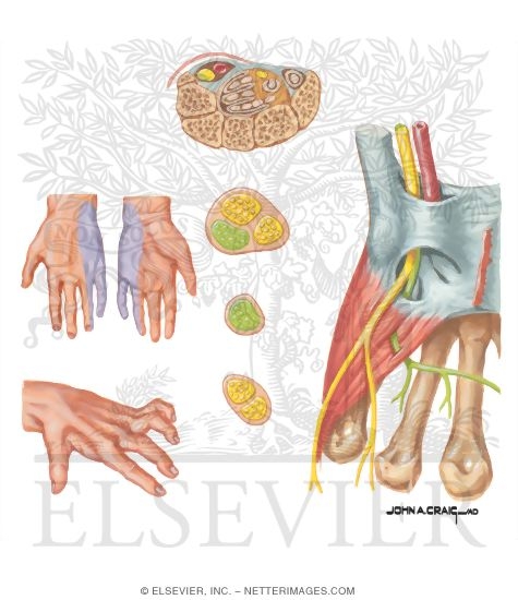 Watermarked preview of unlabeled image: Disorders of the Forearm