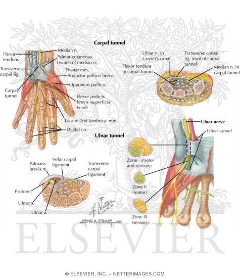 Watermarked preview of labeled image: Forearm: Tunnels