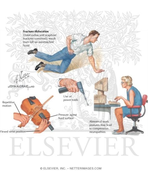 Watermarked preview of labeled image: History of Forearm Injury