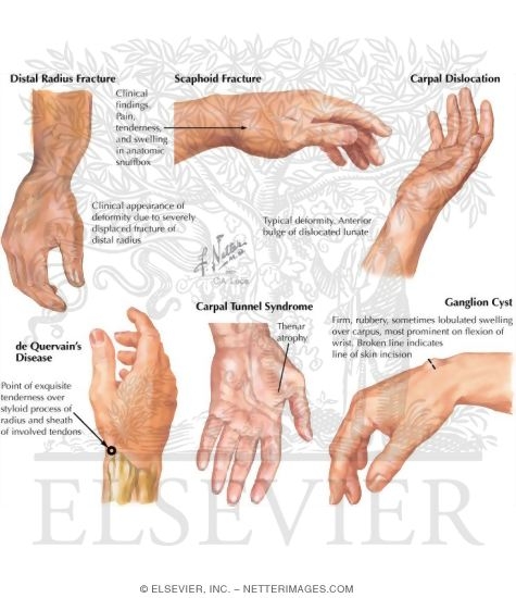 Watermarked preview of labeled image: Physical Examination of the Forearm