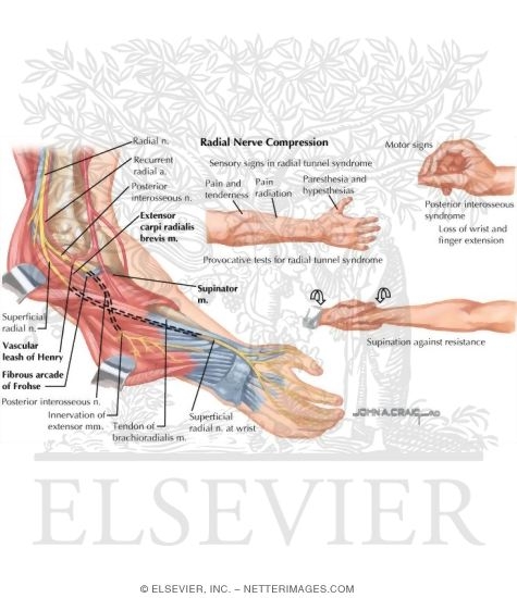 Watermarked preview of labeled image: Disorders of the Forearm