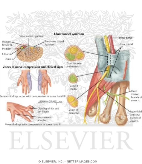 Watermarked preview of labeled image: Disorders of the Forearm