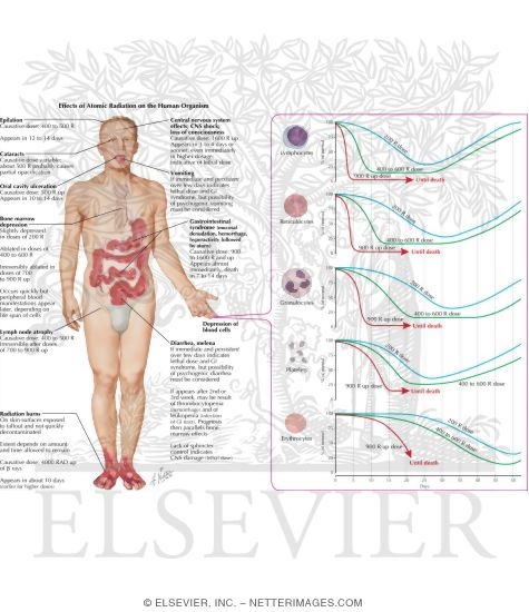 Watermarked preview of labeled image: Effects Of Radiation On Humans