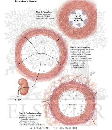 Watermarked preview of labeled image: Biochemistry of Migraine