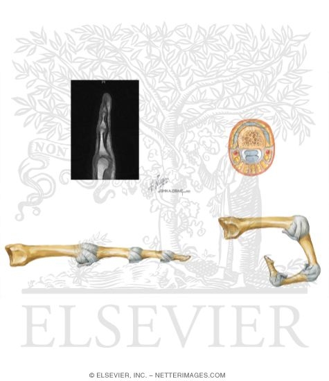 Watermarked preview of unlabeled image: Joints of the Hand