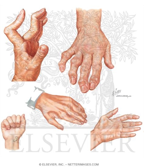 Watermarked preview of unlabeled image: Physical Examination of the Hand