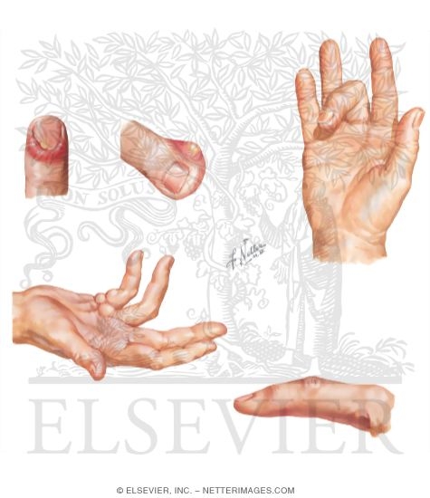 Watermarked preview of unlabeled image: Physical Examination of the Hand