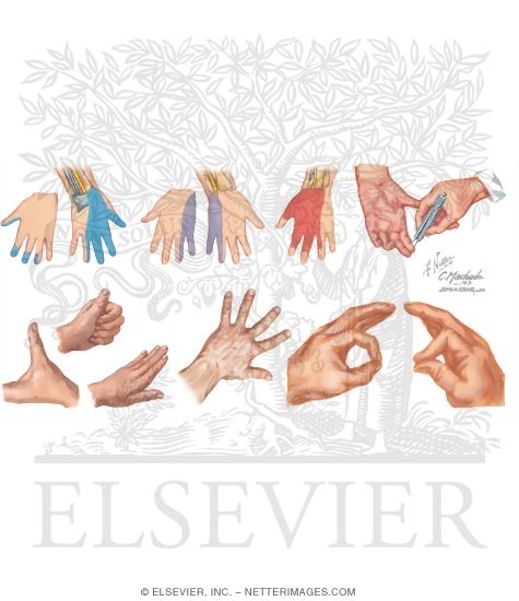 Watermarked preview of unlabeled image: Physical Examination of the Hand
