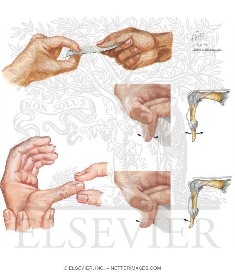 Watermarked preview of unlabeled image: Physical Examination of the Hand