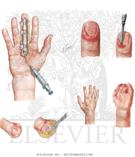 Watermarked preview of unlabeled image: Disorders of the Hand