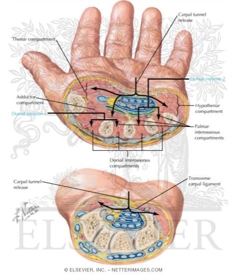 Section Through Metacarpal Bones - Section Through Distal Carpal Bones