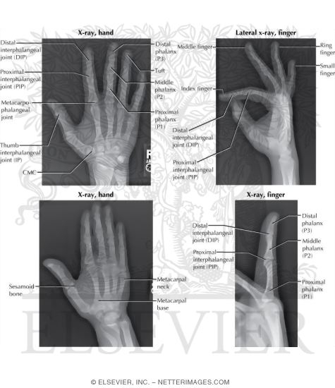 Radiology of the Hand