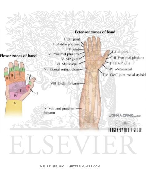 Watermarked preview of labeled image: Tendons of the Hand