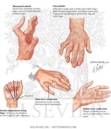 Watermarked preview of labeled image: Physical Examination of the Hand