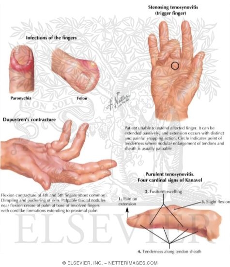 Physical Examination of the Hand