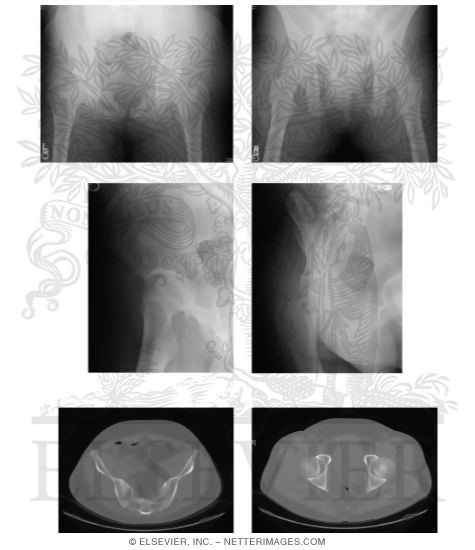 Watermarked preview of unlabeled image: Radiology of the Pelvis