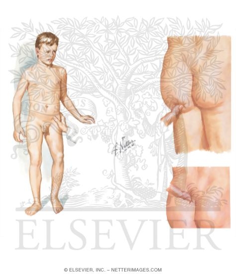 Watermarked preview of unlabeled image: Physical Exam of the Pelvis