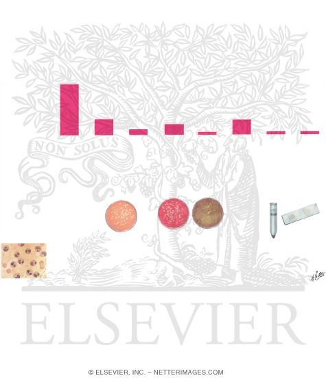 Watermarked preview of unlabeled image: Traveler's Diarrhea: Incidence and Differential Features