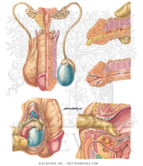 Sexually Transmitted Diseases: Gonorrhea in the Male