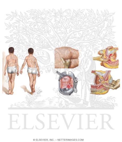 Watermarked preview of unlabeled image: Physical Examination of the Pelvis