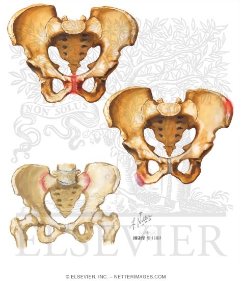 Watermarked preview of unlabeled image: Disorders of the Pelvis